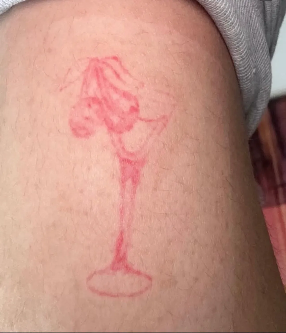 Cover-up Tattoo Zürich — vorher