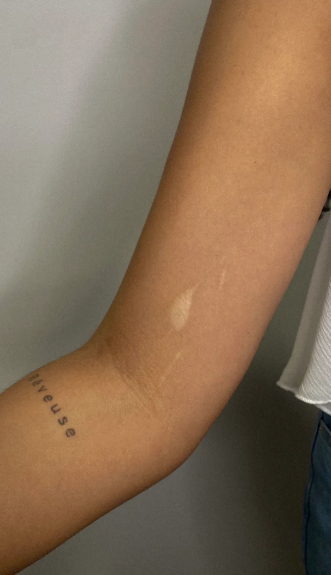 Tattoo über Narbe — Sinkply Zürich