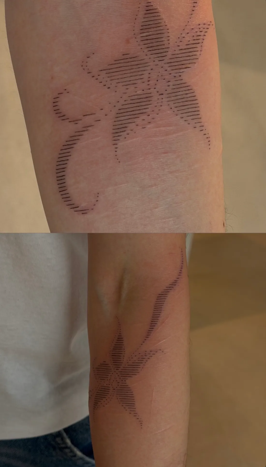 Tattoo über Narbe — Sinkply Zürich